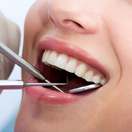 ایمپلنت دندان